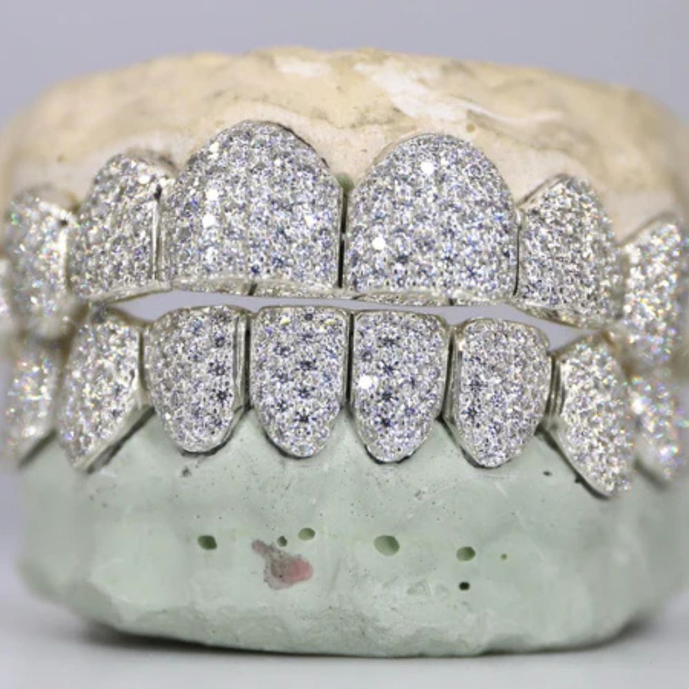 Fully Iced Out Moissanite 8 On 8 Grillz