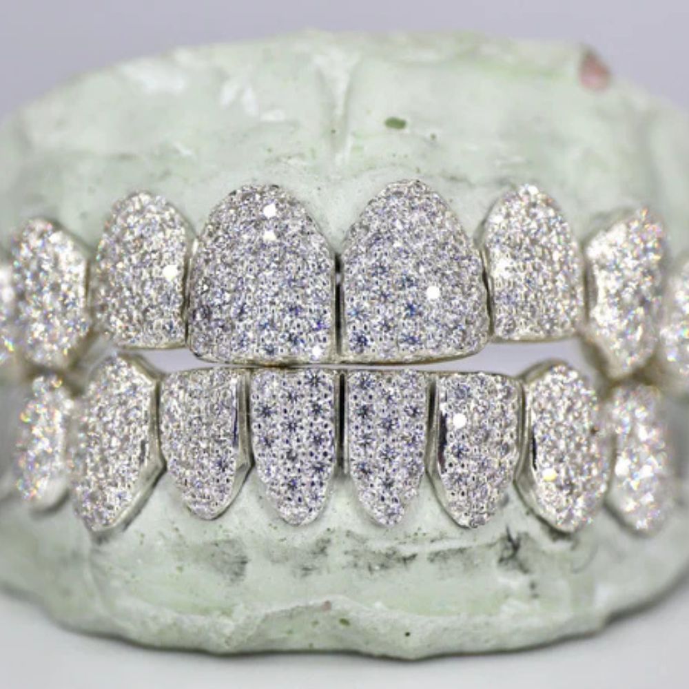 Moissanite Iced Out Customized Grillz For Men