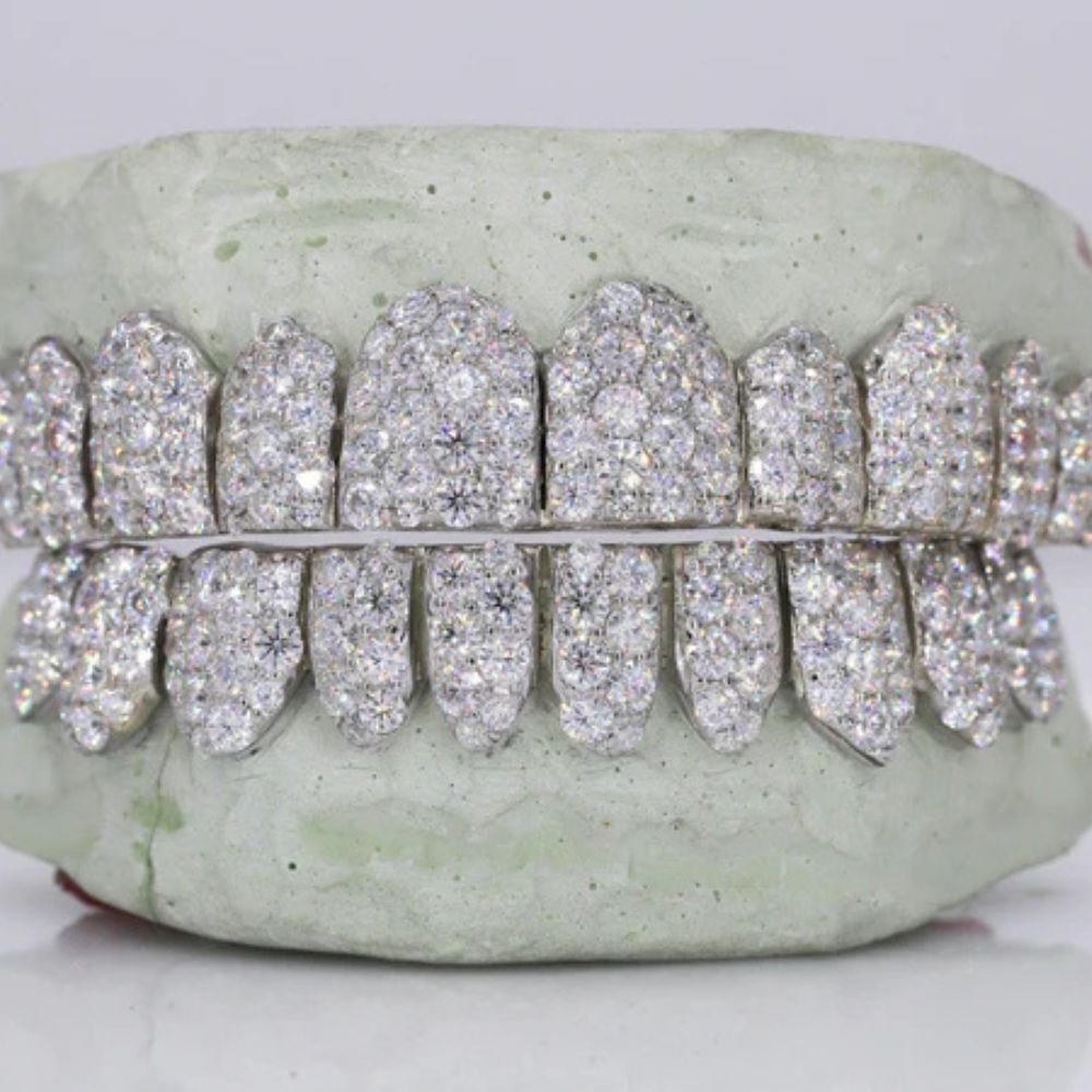 VVS1 Moissanite Fully Iced Out Teeth Grillz