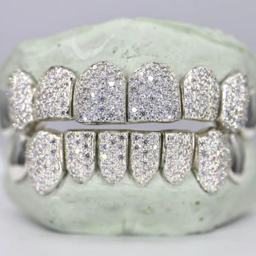 Iced Out Moissanite Elegant Hip Hop Grillz
