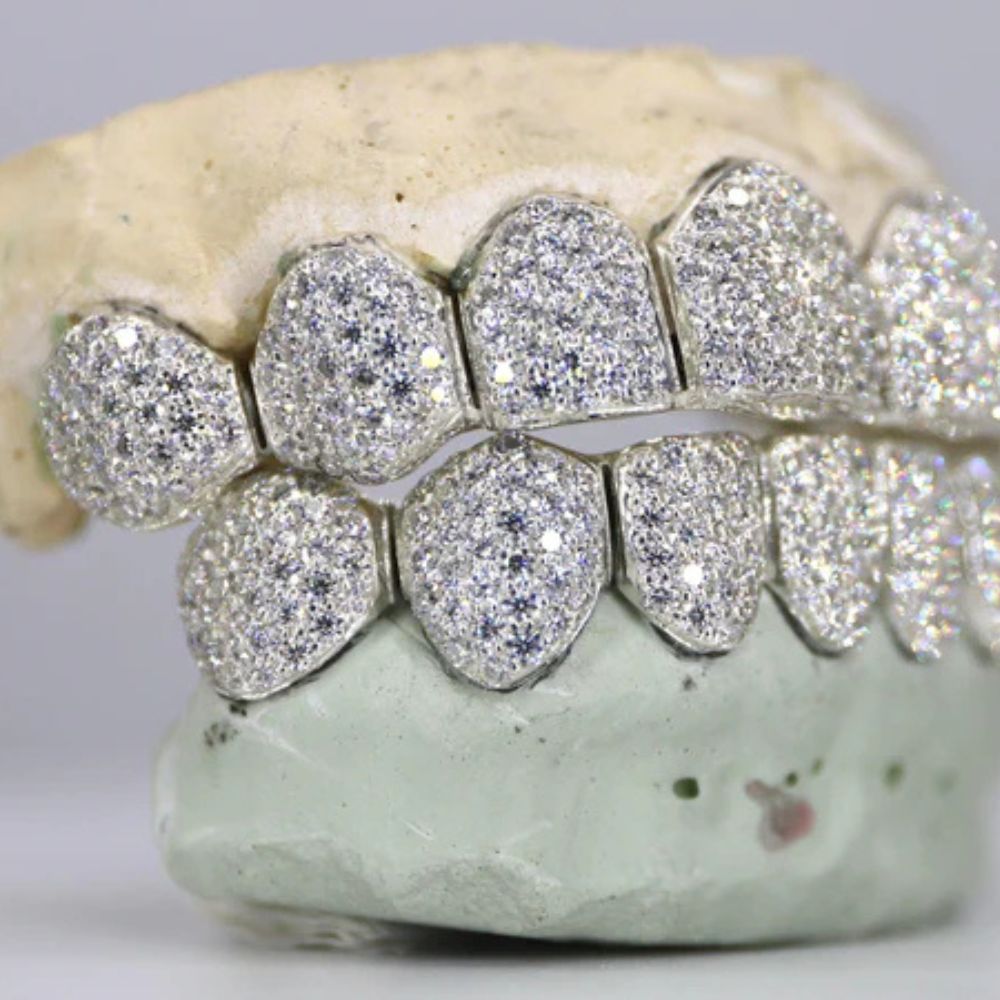 Fully Iced Out Moissanite 8 On 8 Grillz