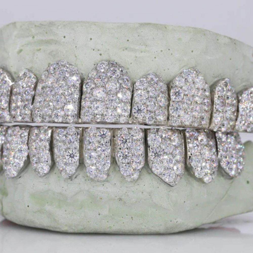 VVS1 Moissanite Fully Iced Out Teeth Grillz