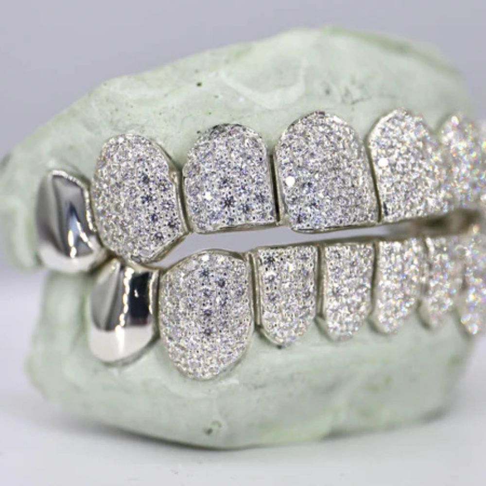 Iced Out Moissanite Elegant Hip Hop Grillz