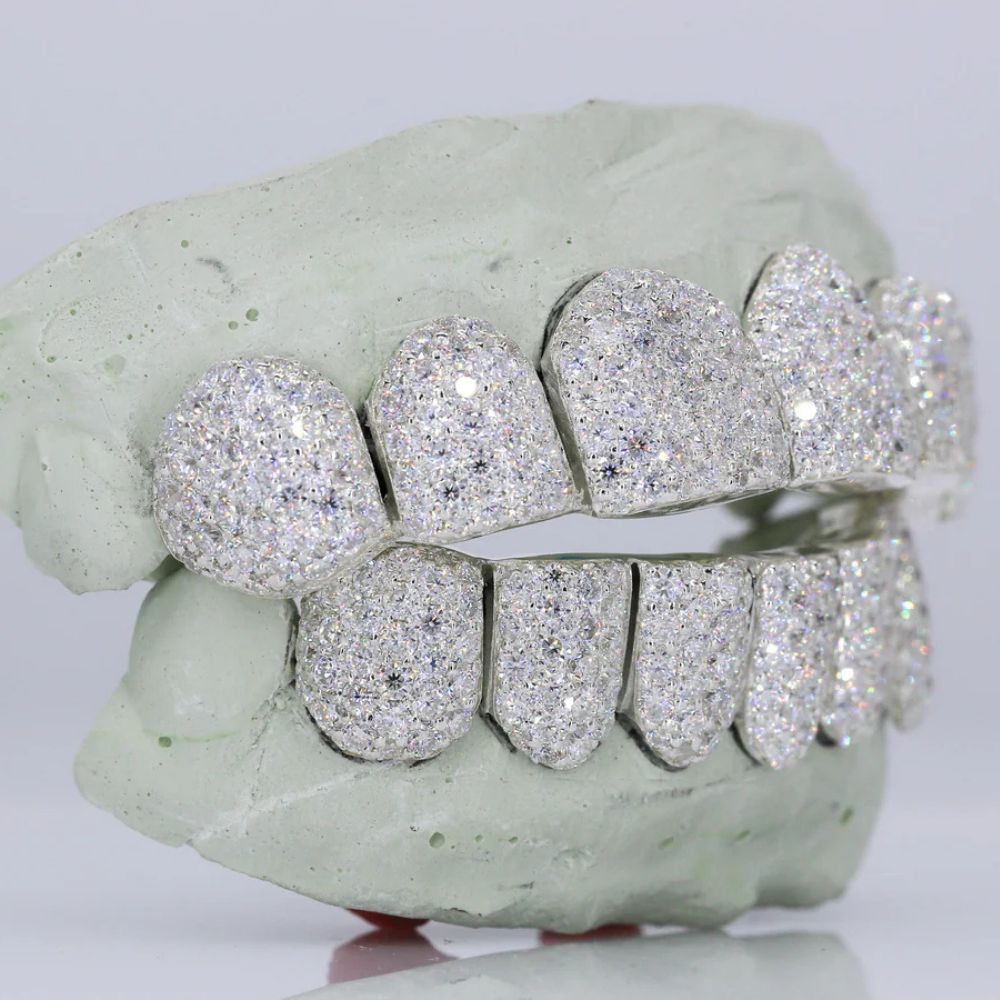 Iced Out Moissanite Luxury Hip Hop Grillz