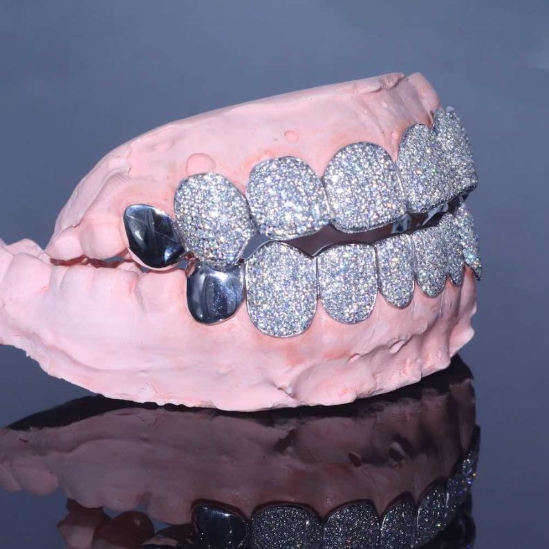 Iced Out Moissanite Elegant Grillz