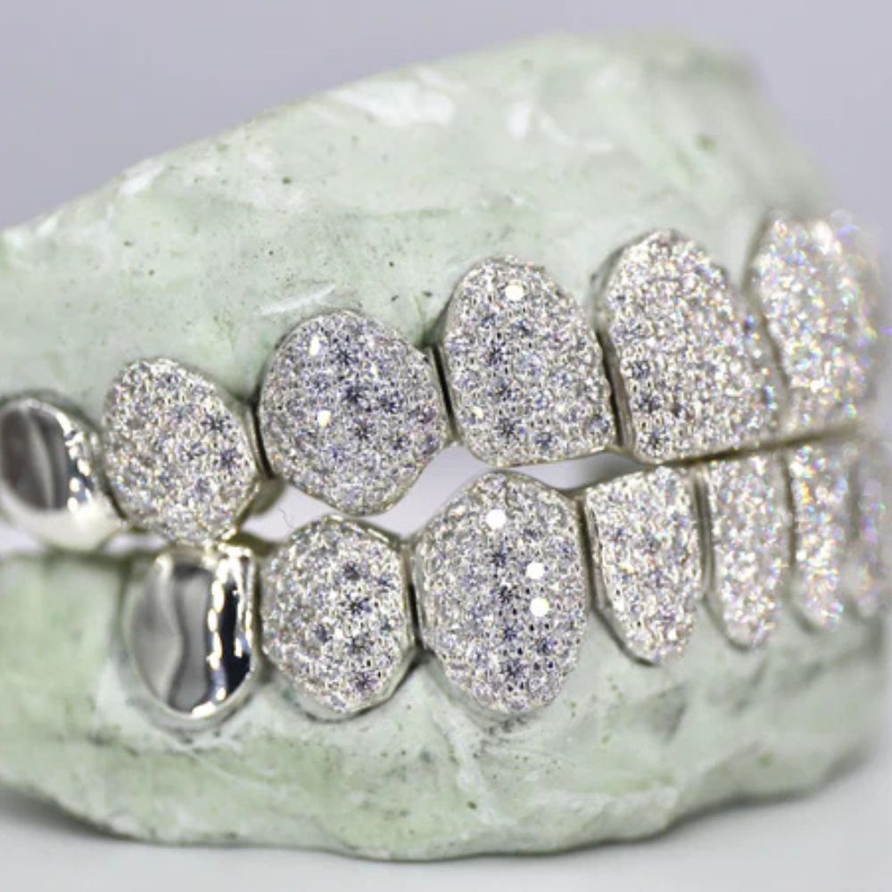 Moissanite Iced Out Customized Grillz For Men