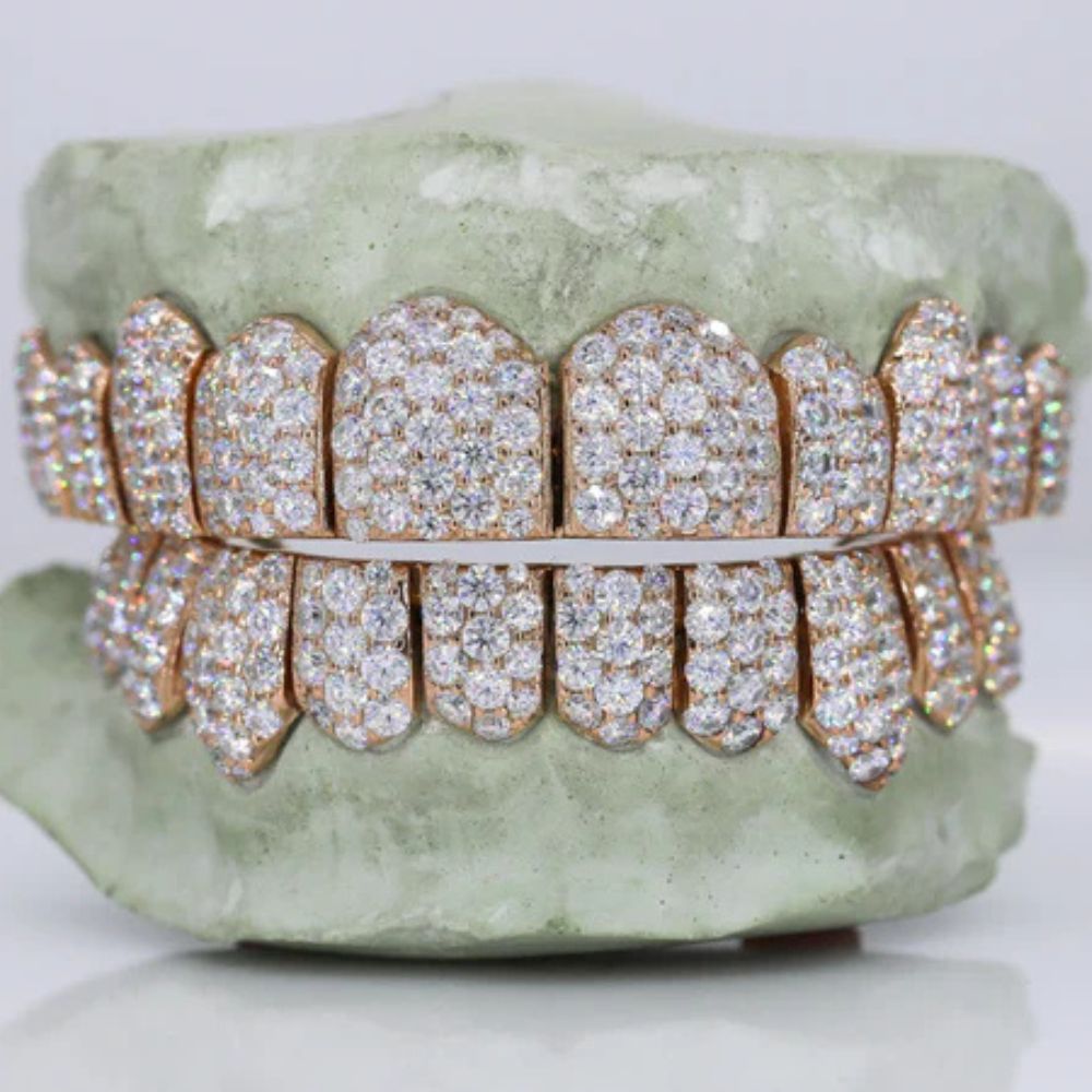 VVS1 Moissanite Fully Iced Out Teeth Grillz