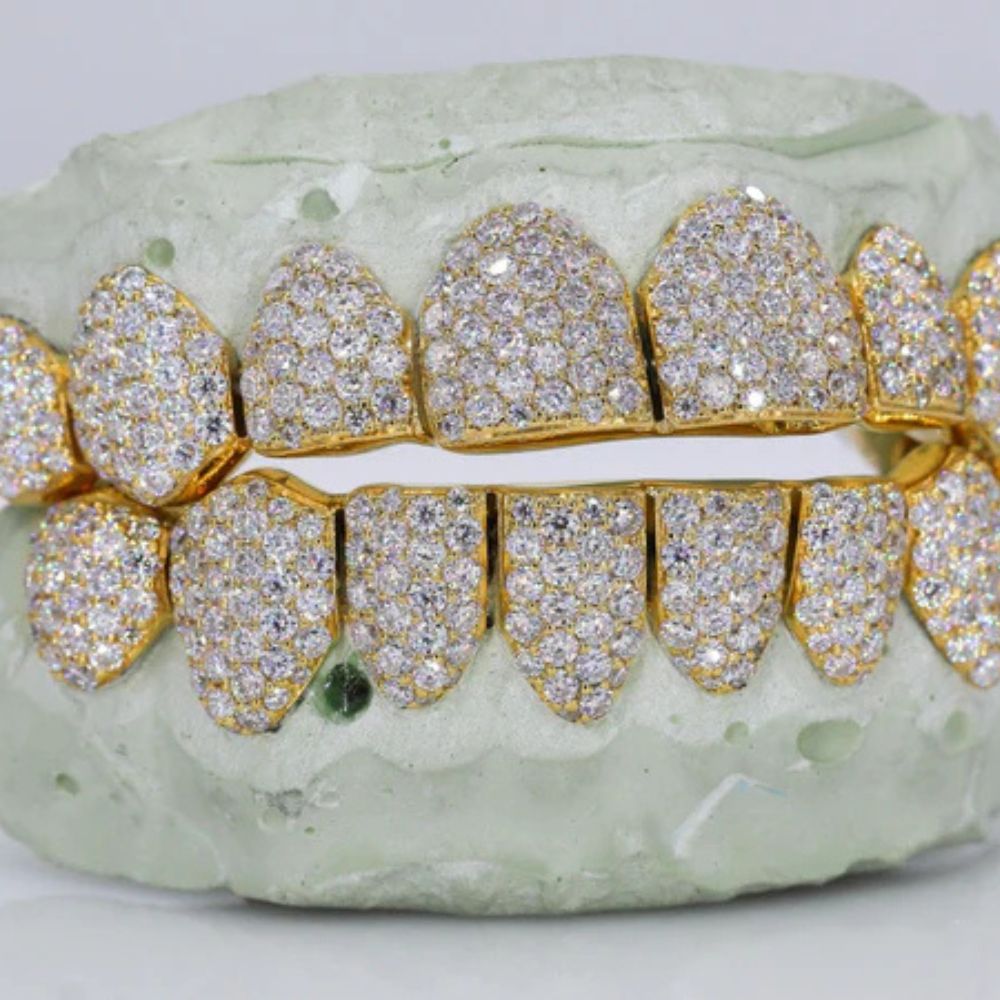 Fully Iced Out Moissanite 8 On 8 Grillz