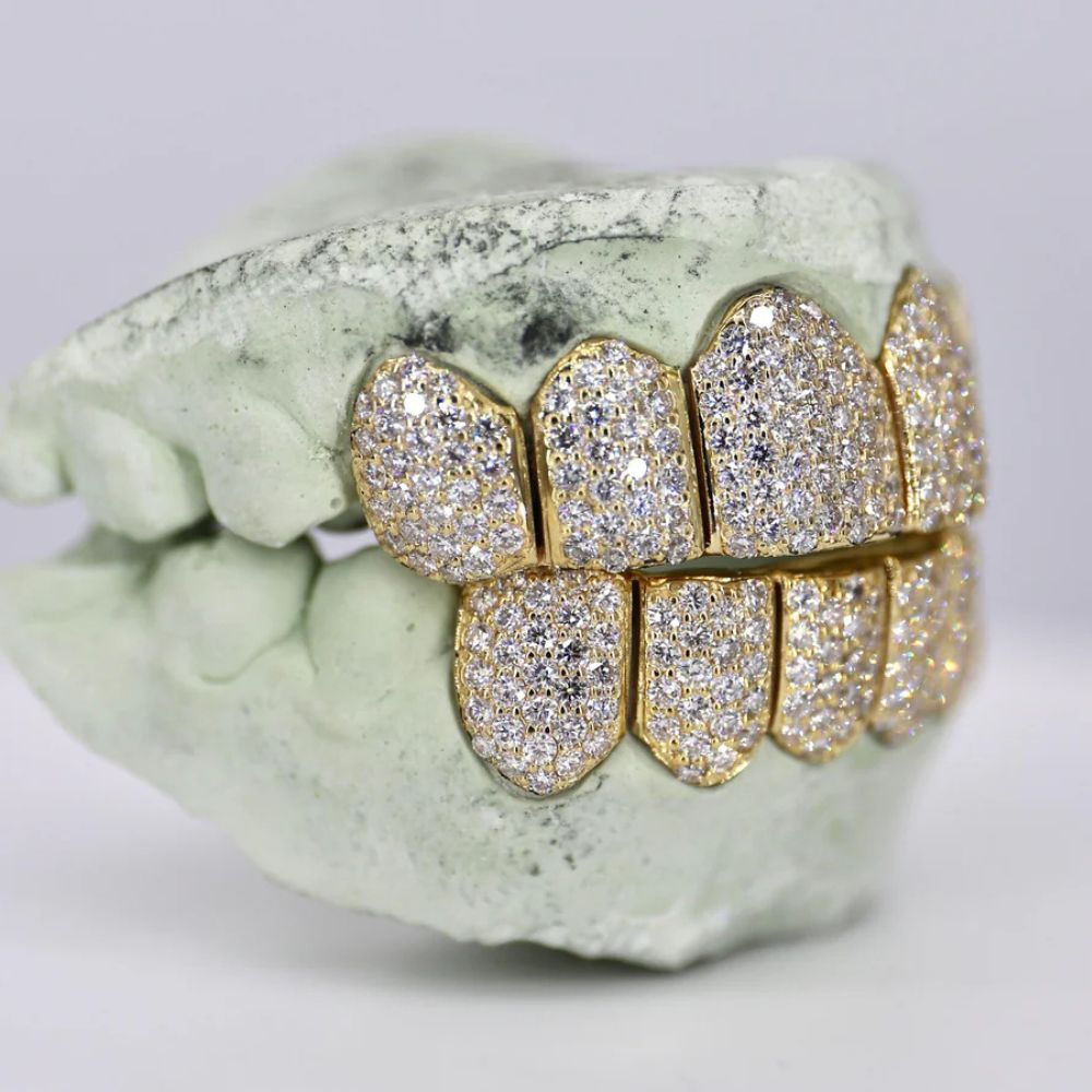 Iced Out Moissanite Luxury Hip Hop Grillz