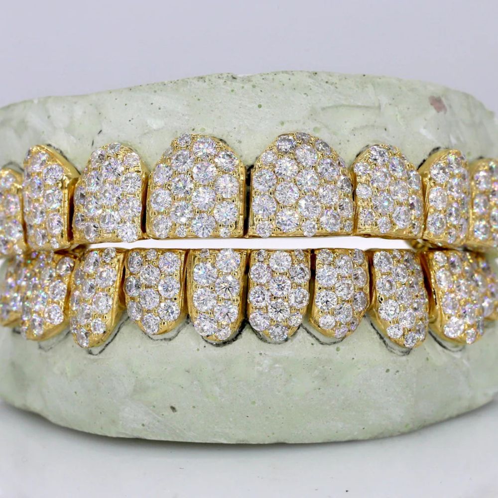 VVS1 Moissanite Iced Out Hip Hop Grillz For Men