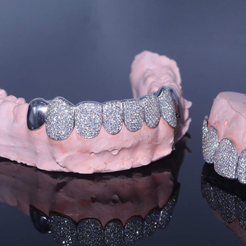 Iced Out Moissanite Elegant Grillz