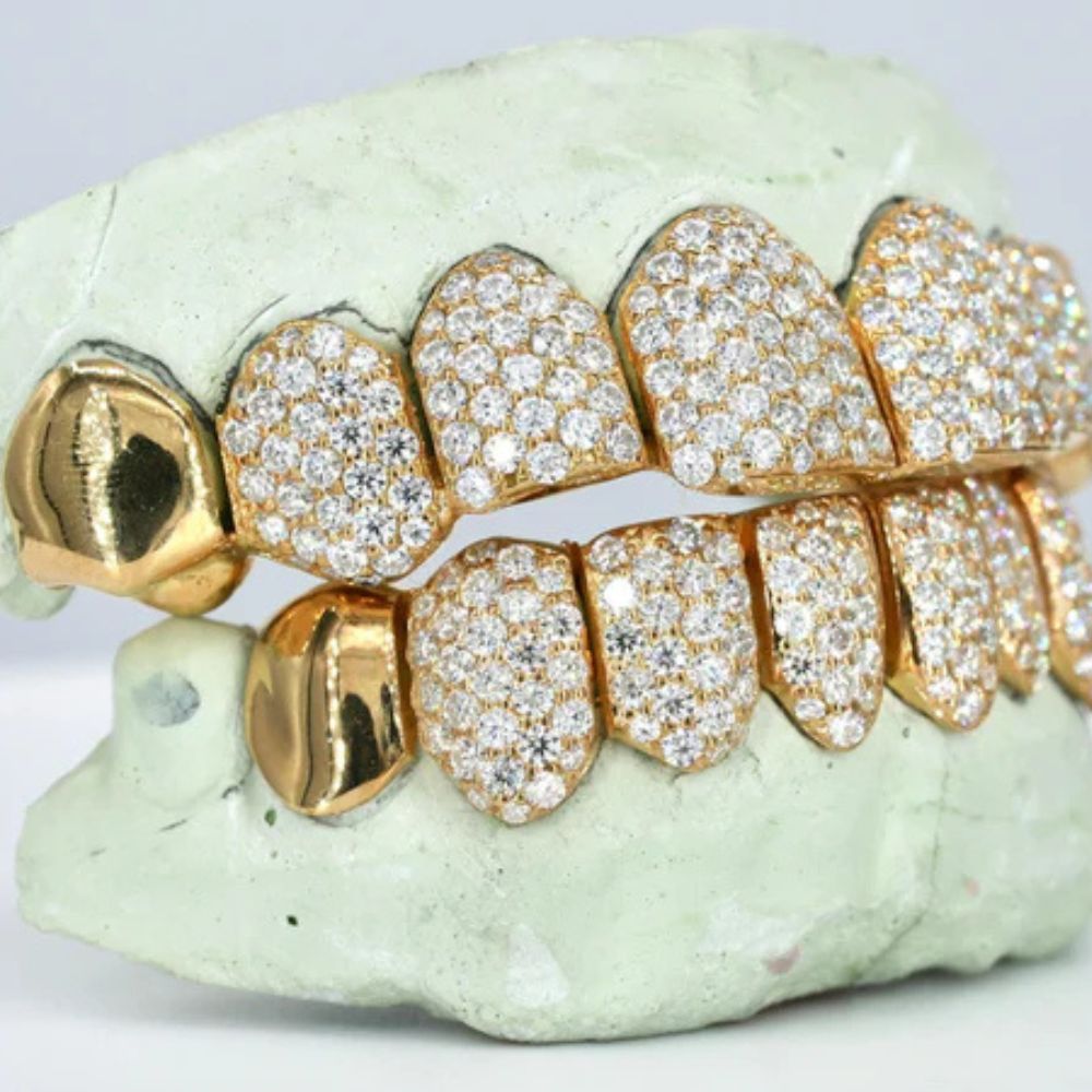 Iced Out Moissanite Elegant Hip Hop Grillz
