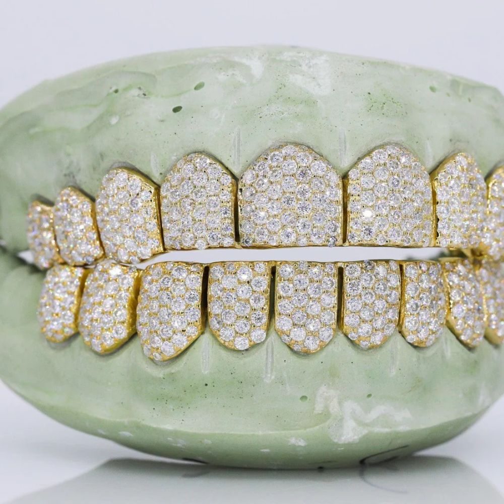 10 On 10 VVS1 Iced Out  Moissanite Grillz