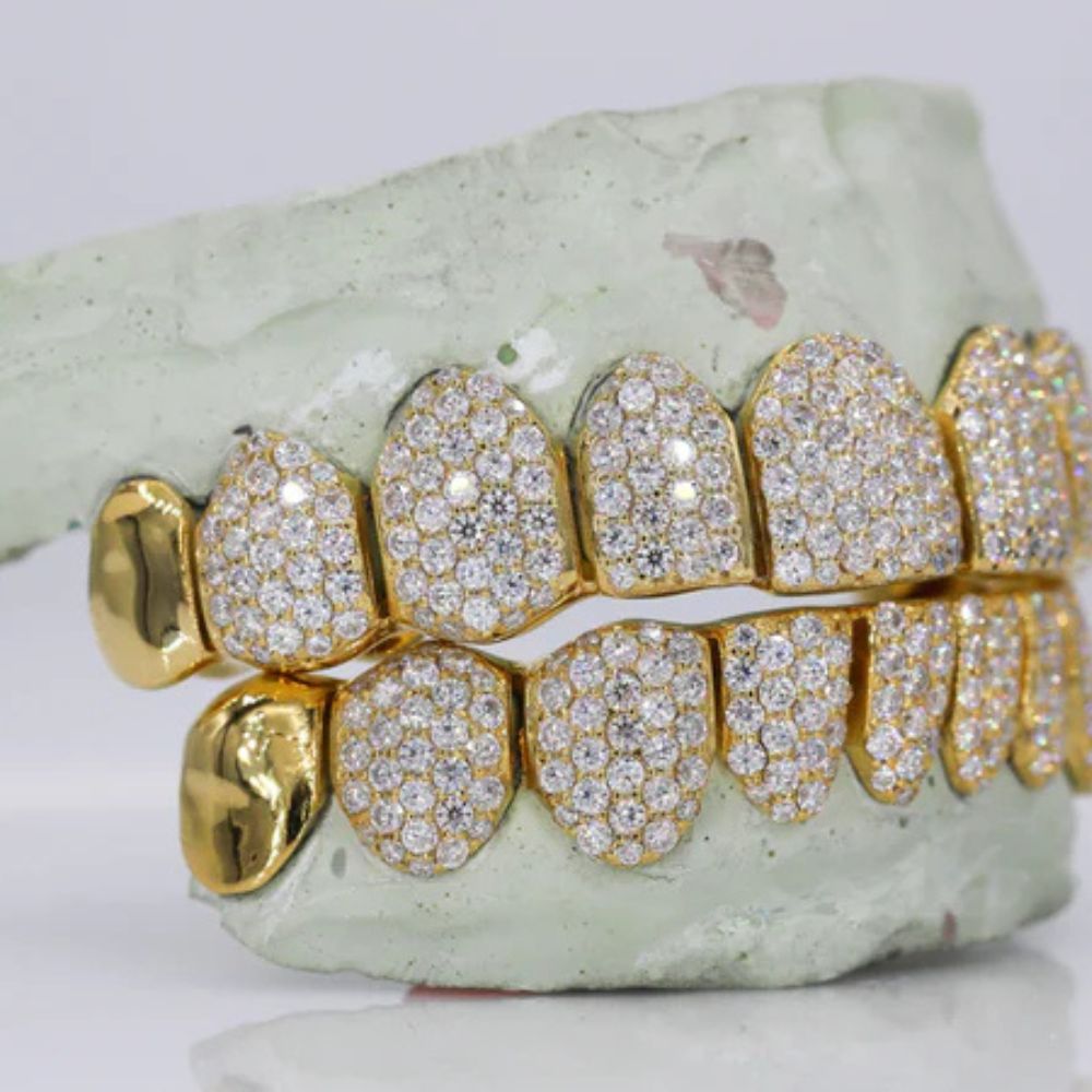 Moissanite Iced Out Customized Grillz For Men