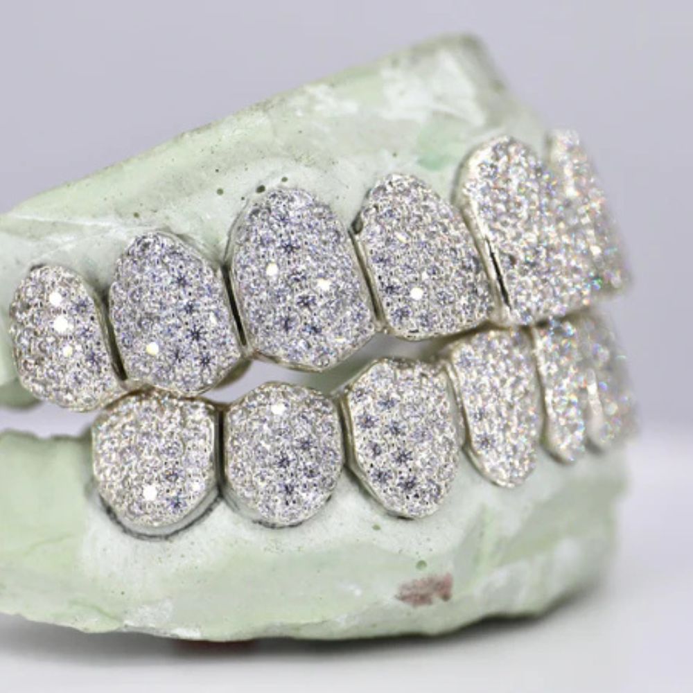 10 On 10 Moissanite Fully Iced Out Teeth Grillz