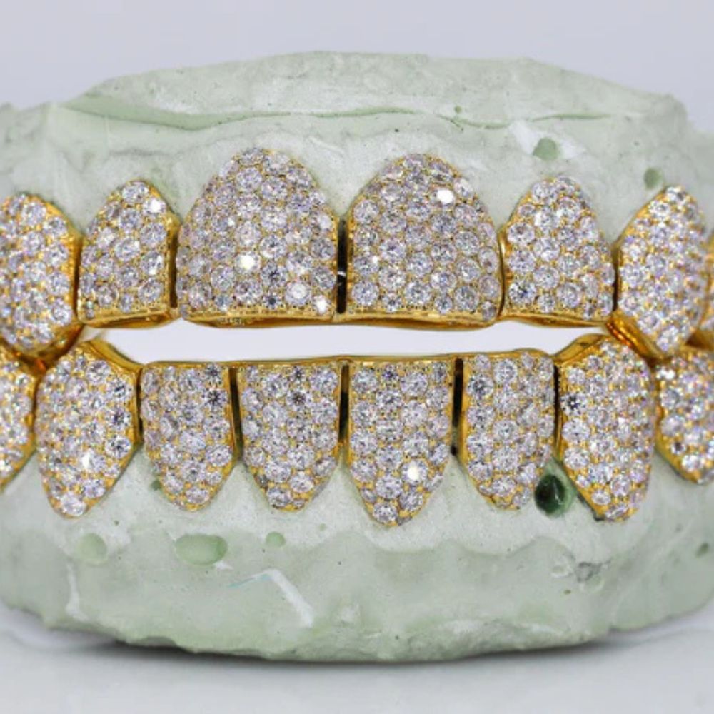 Fully Iced Out Moissanite 8 On 8 Grillz
