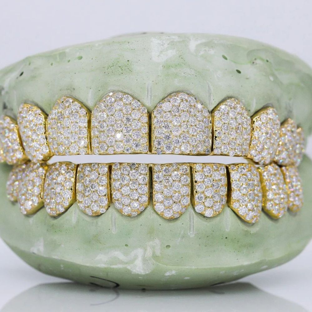 10 On 10 VVS1 Iced Out  Moissanite Grillz