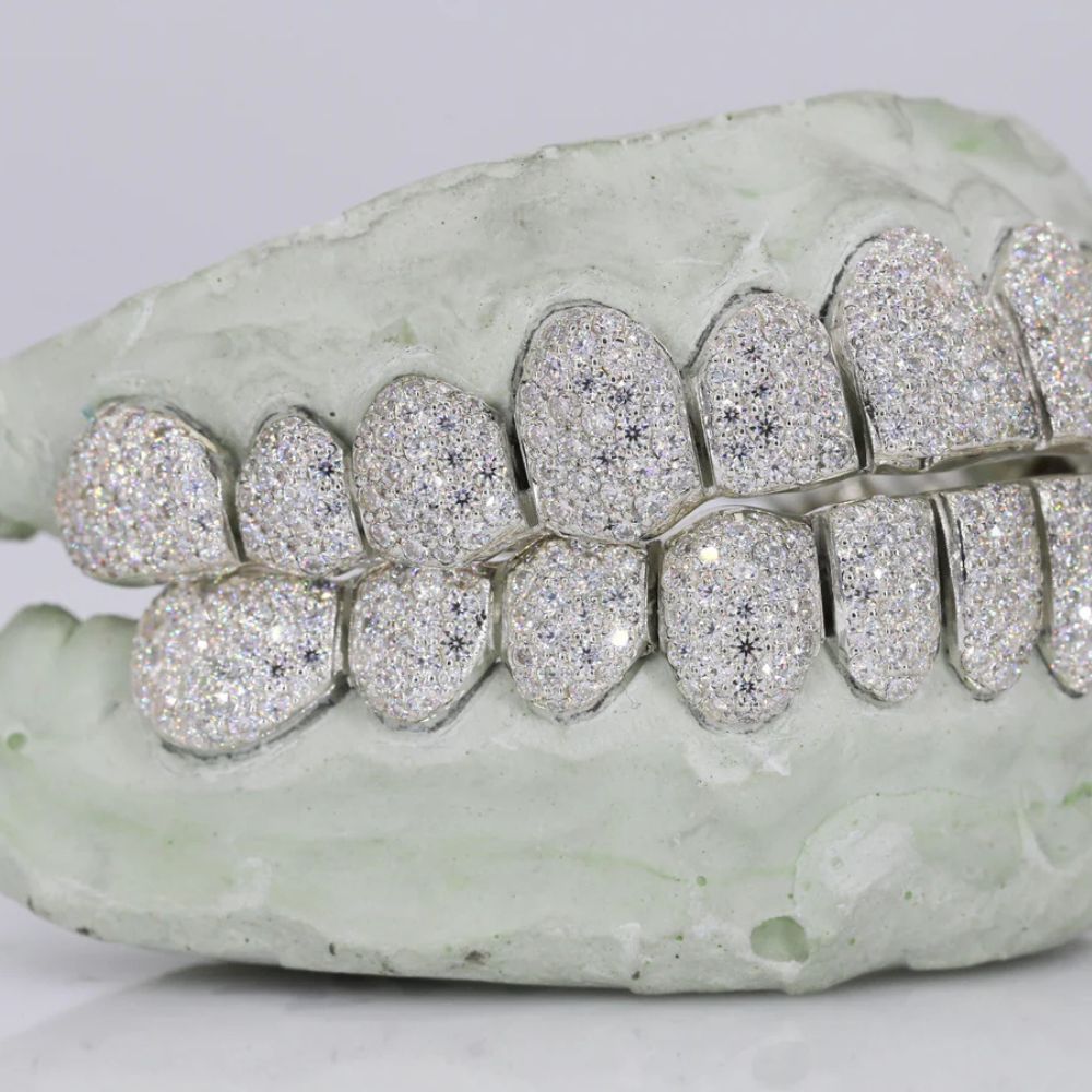 Moissanite Diamond Iced Out Customized Teeth Grillz