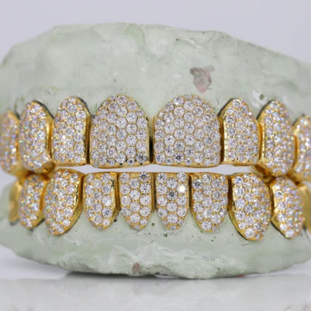 Moissanite Iced Out Customized Grillz For Men