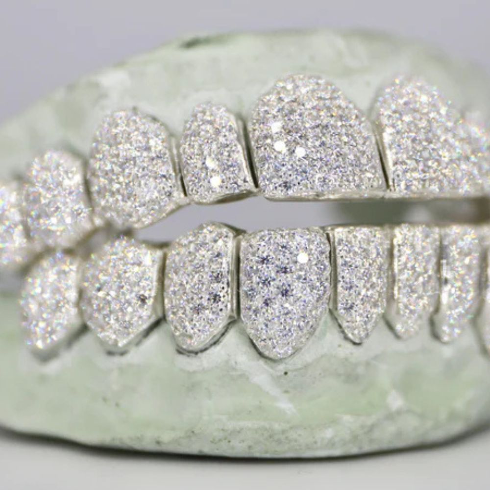 10 On 10 Moissanite Fully Iced Out Teeth Grillz