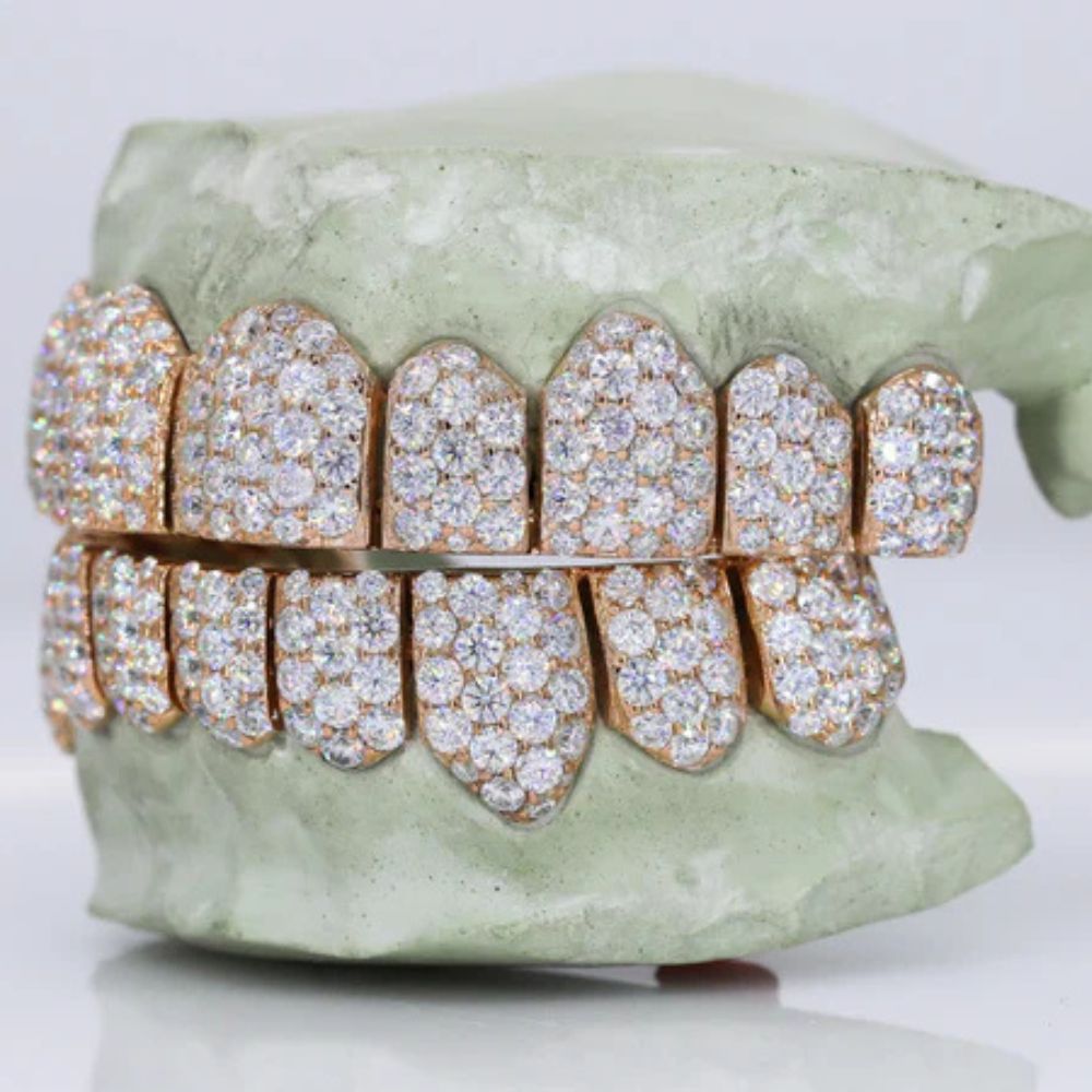 VVS1 Moissanite Fully Iced Out Teeth Grillz
