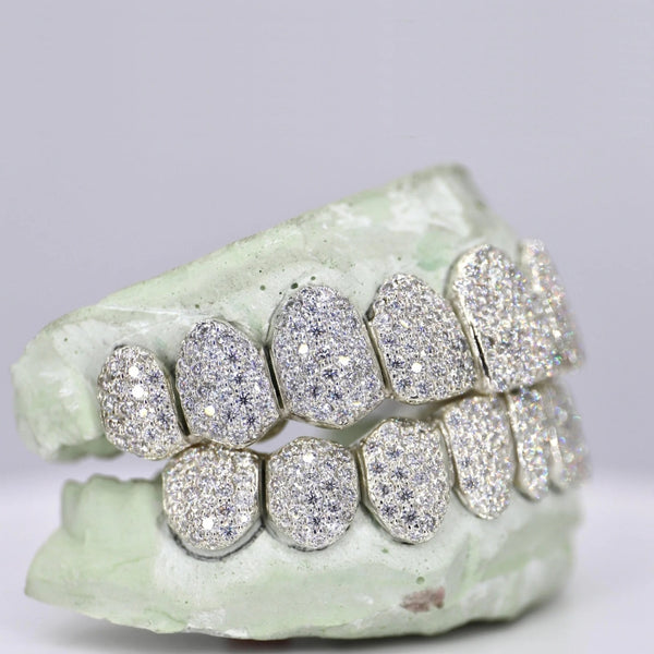 10 On 10 VVS1 Moissanite Diamond Iced Out Customized Grillz