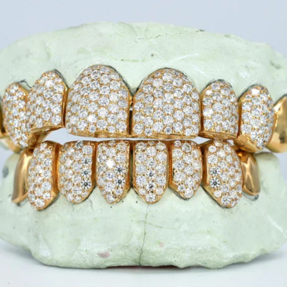 Iced Out Moissanite Elegant Hip Hop Grillz