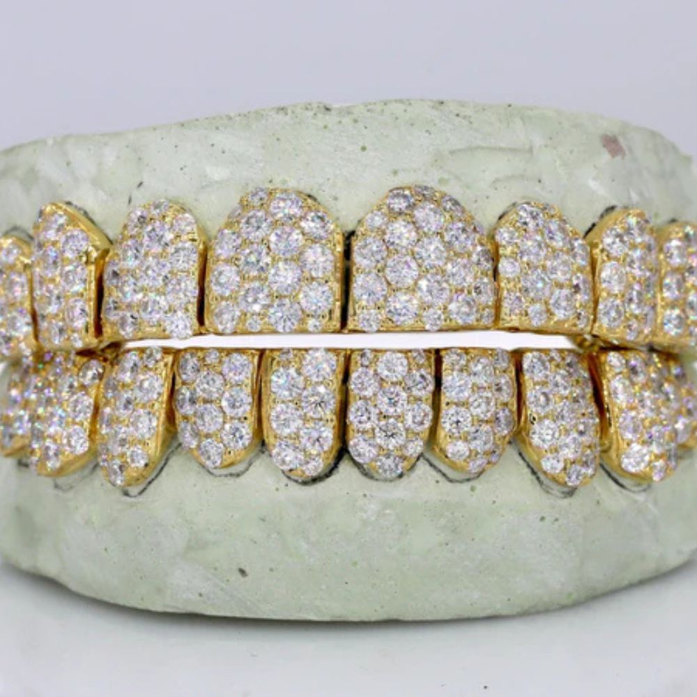 VVS1 Moissanite Fully Iced Out Teeth Grillz