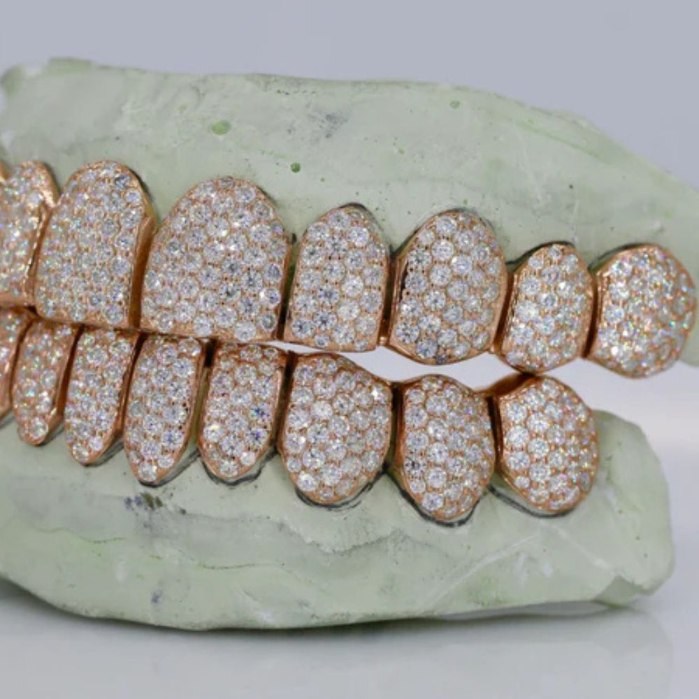 10 On 10 Moissanite Fully Iced Out Teeth Grillz
