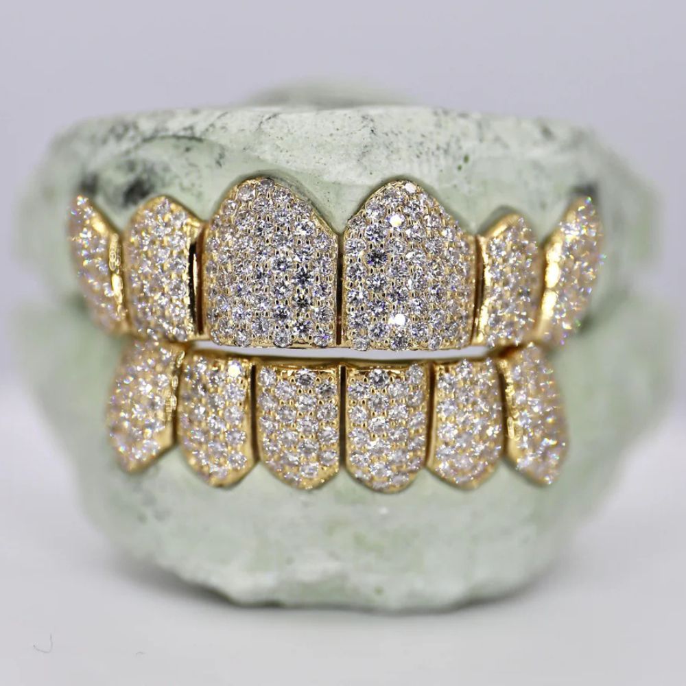 Iced Out Moissanite Luxury Hip Hop Grillz