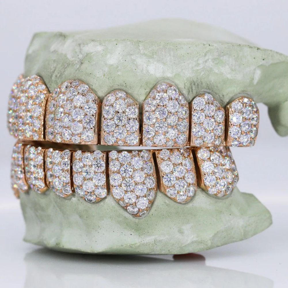 10 On 10 Iced Out Moissanite Customized Grillz