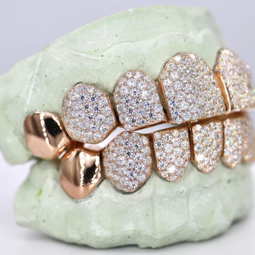 Iced Out Moissanite Elegant Hip Hop Grillz