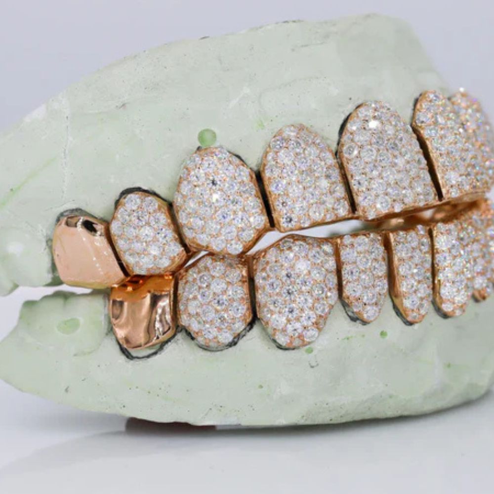 Moissanite Iced Out Customized Grillz For Men