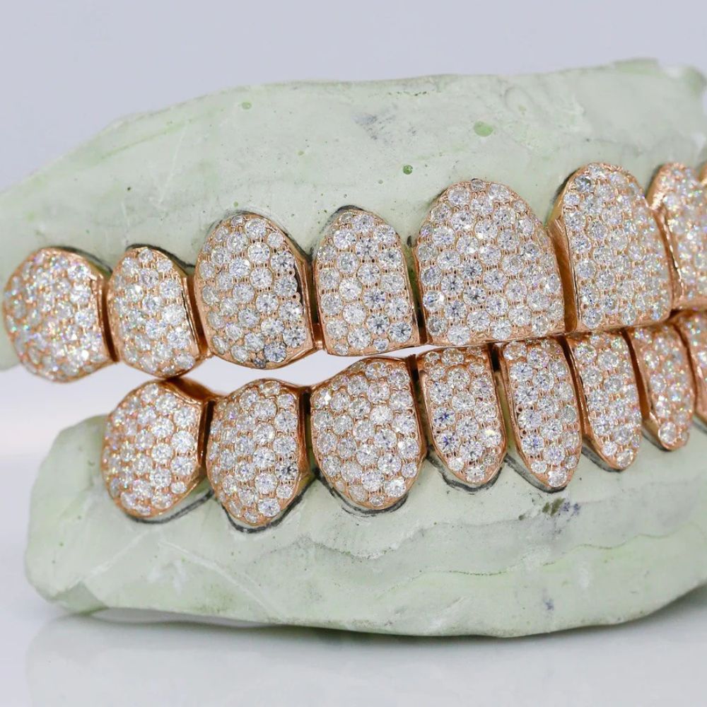 10 On 10 VVS1 Iced Out  Moissanite Grillz
