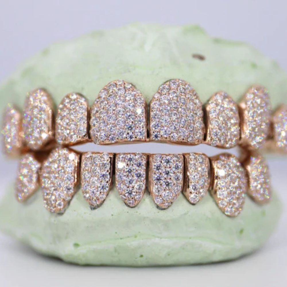 Fully Iced Out Moissanite 8 On 8 Grillz