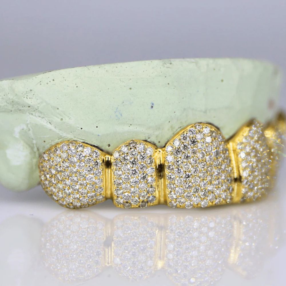 Iced Out Moissanite Luxury Hip Hop Grillz