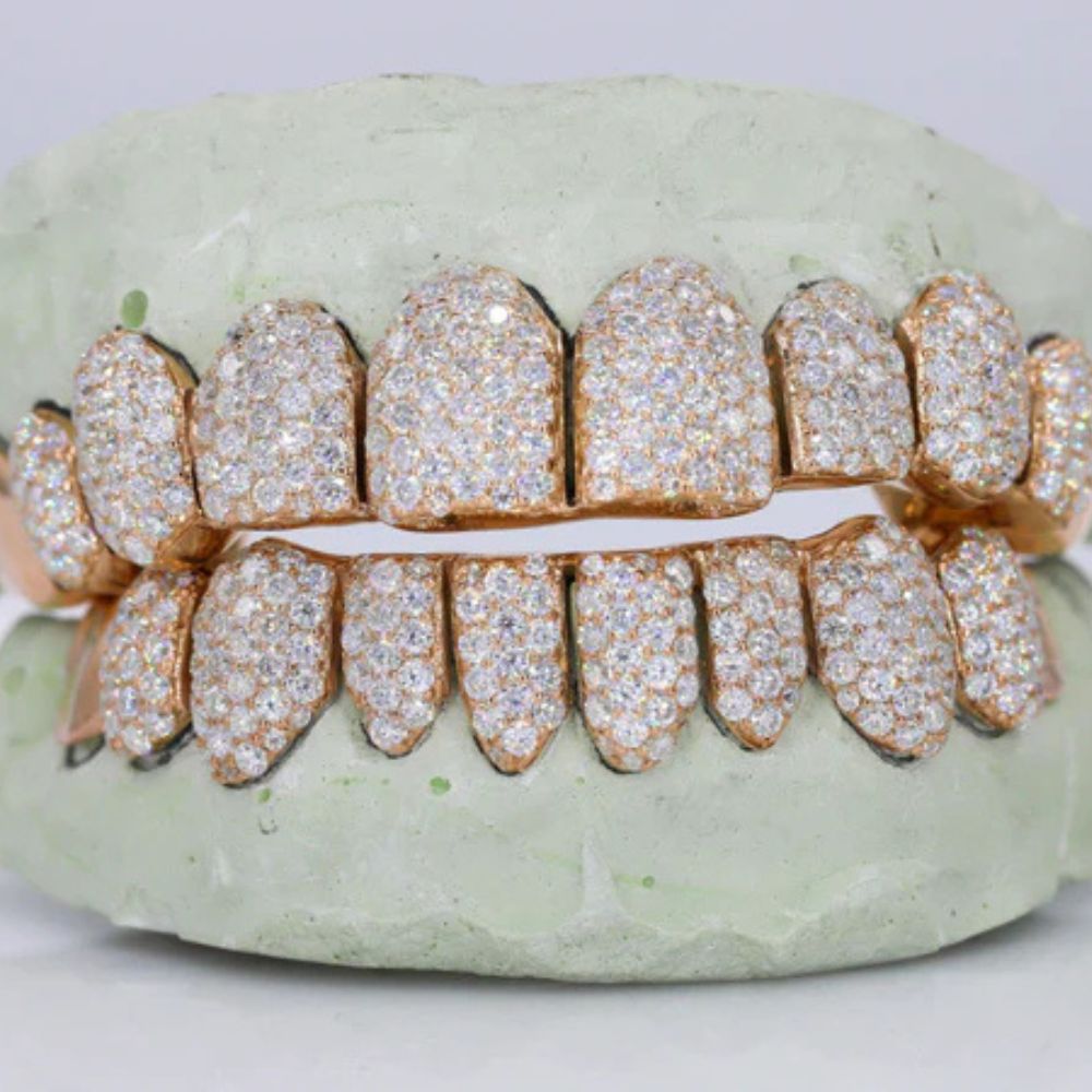 Moissanite Iced Out Customized Grillz For Men