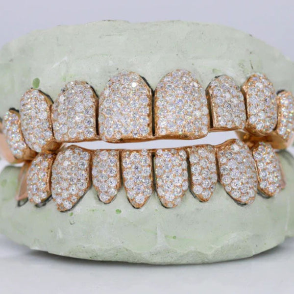 Moissanite Iced Out Customized Grillz For Men