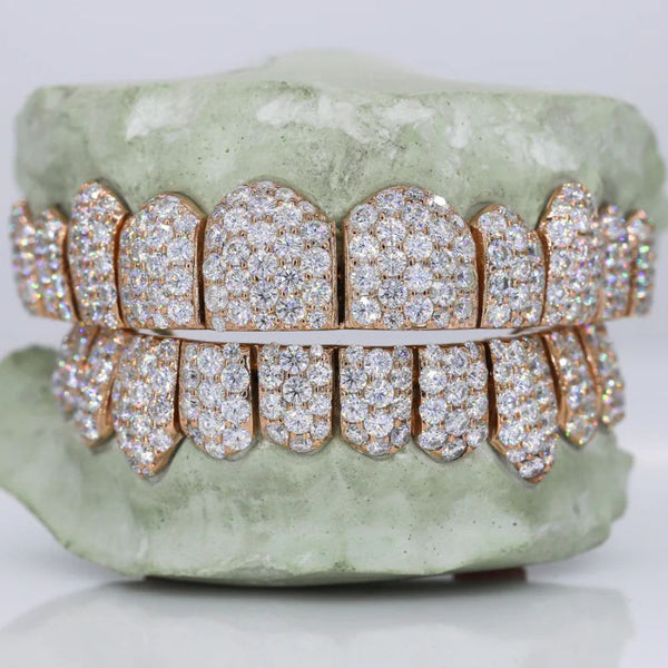 Moissanite 10 On 10 Iced Out Elegant Grillz