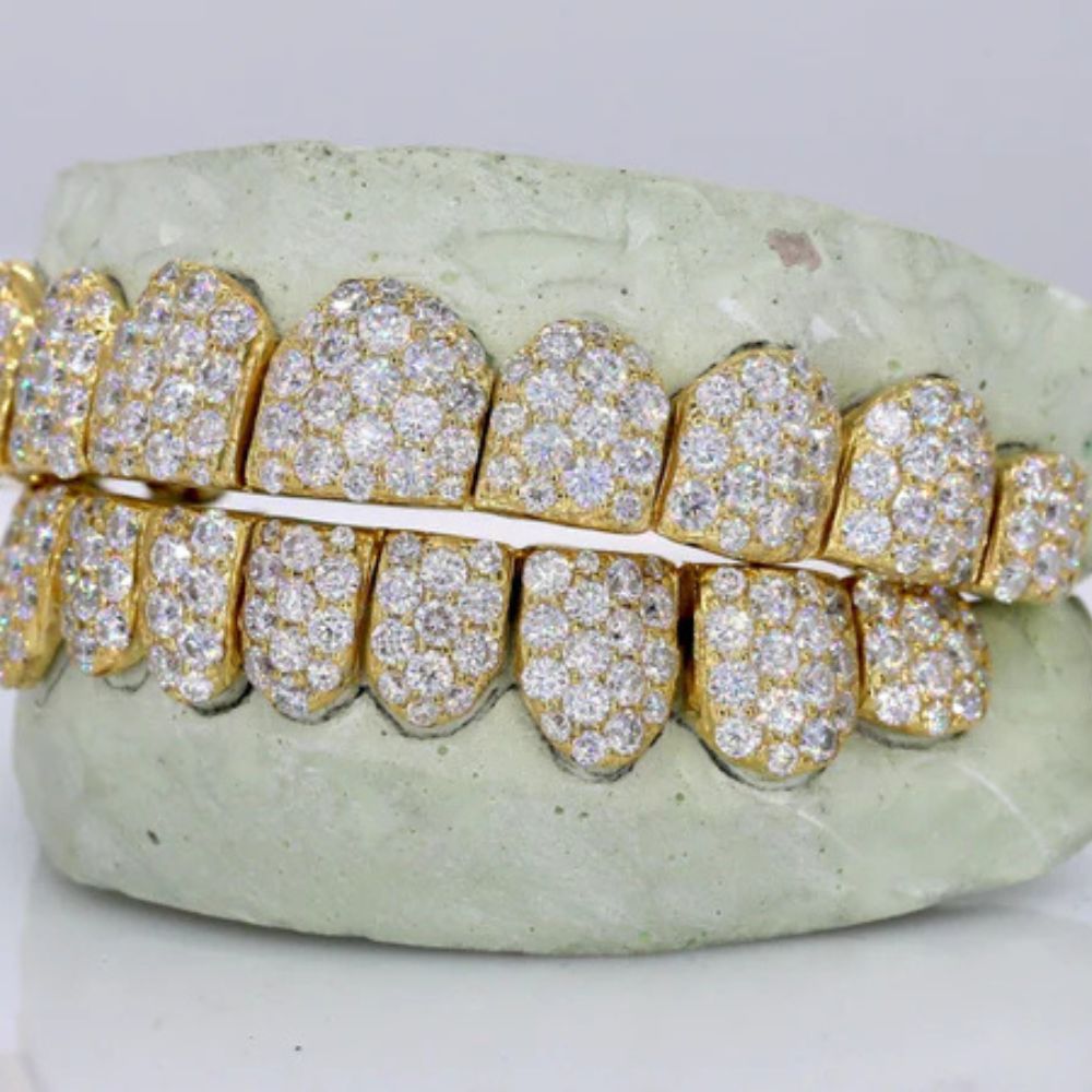 VVS1 Moissanite Fully Iced Out Teeth Grillz