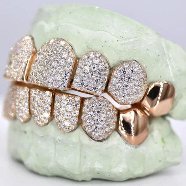 Iced Out VVS1 Moissanite Hip Hop Grillz For Him