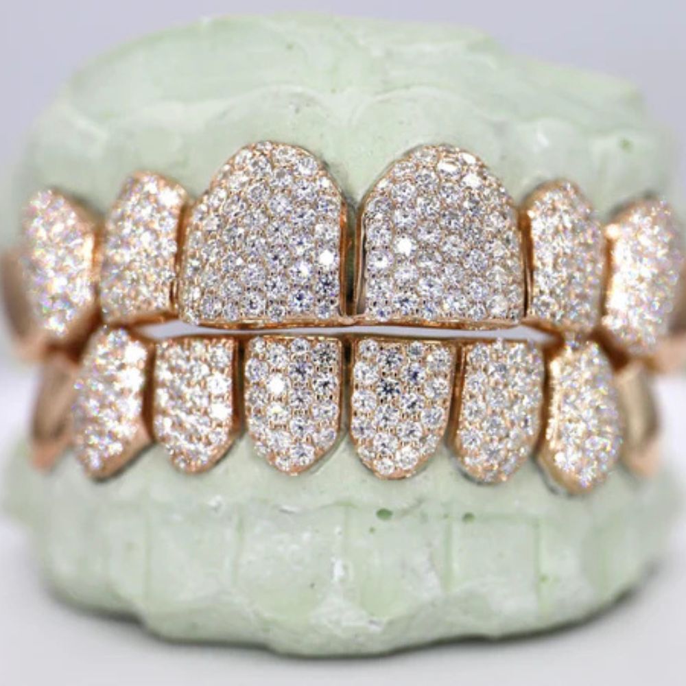 Iced Out Moissanite Elegant Hip Hop Grillz