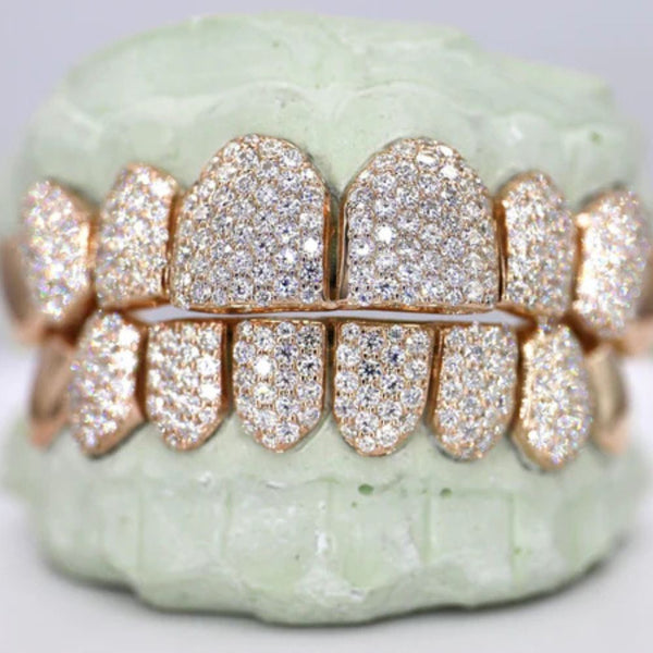 Iced Out Moissanite Elegant Hip Hop Grillz