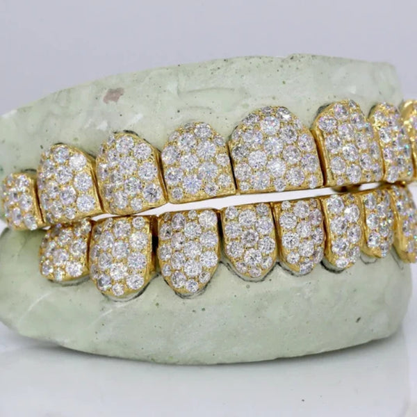 10 On 10 Iced Out Moissanite Diamond Customized Grillz