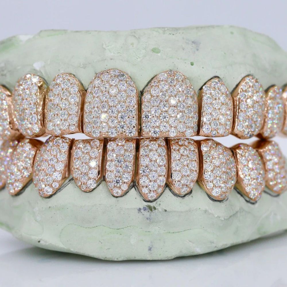 10 On 10 VVS1 Iced Out  Moissanite Grillz