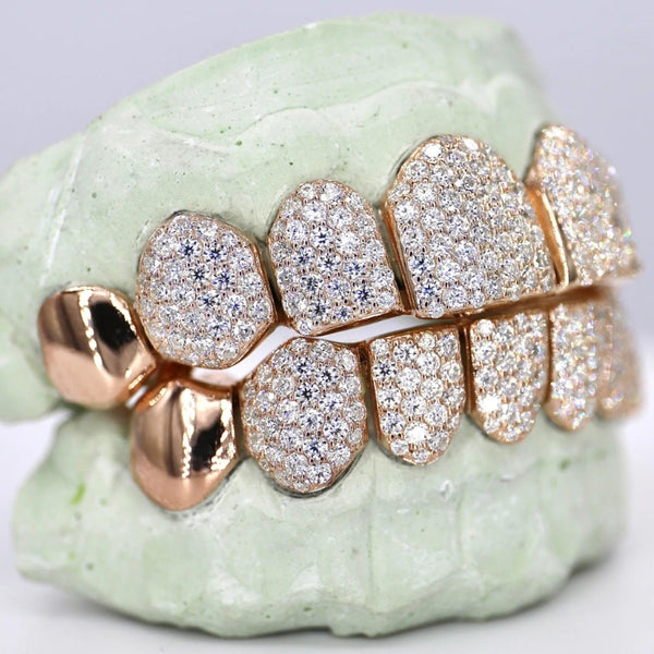 VVS1 Moissanite Iced Out Custom Made 8 On 8 Grillz