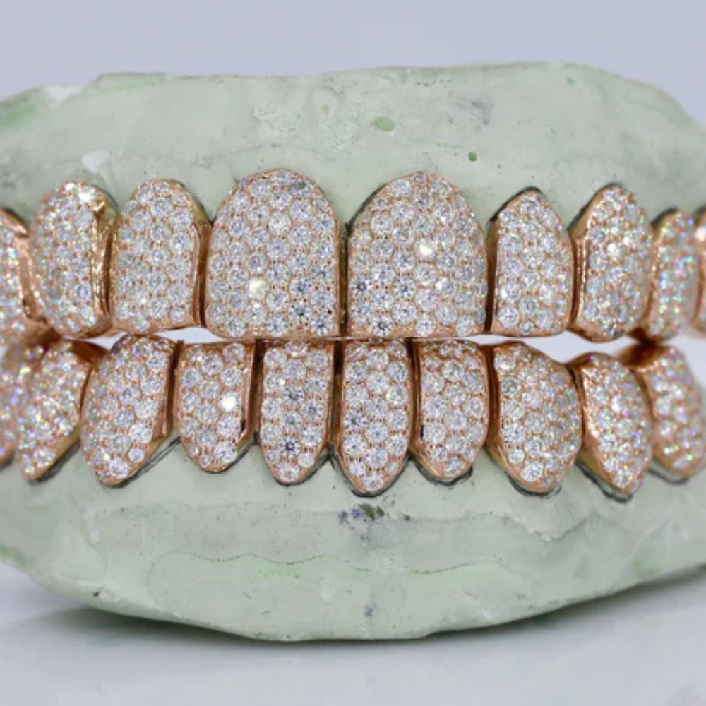10 On 10 Moissanite Fully Iced Out Teeth Grillz