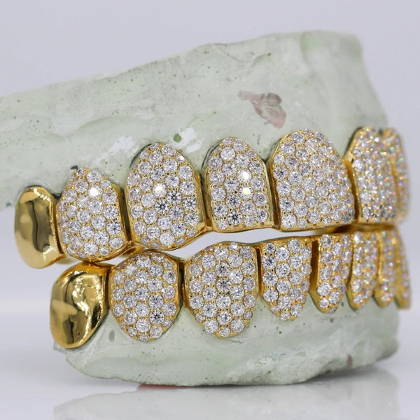 Iced Out VVS1 Moissanite 10 On 10 Grillz